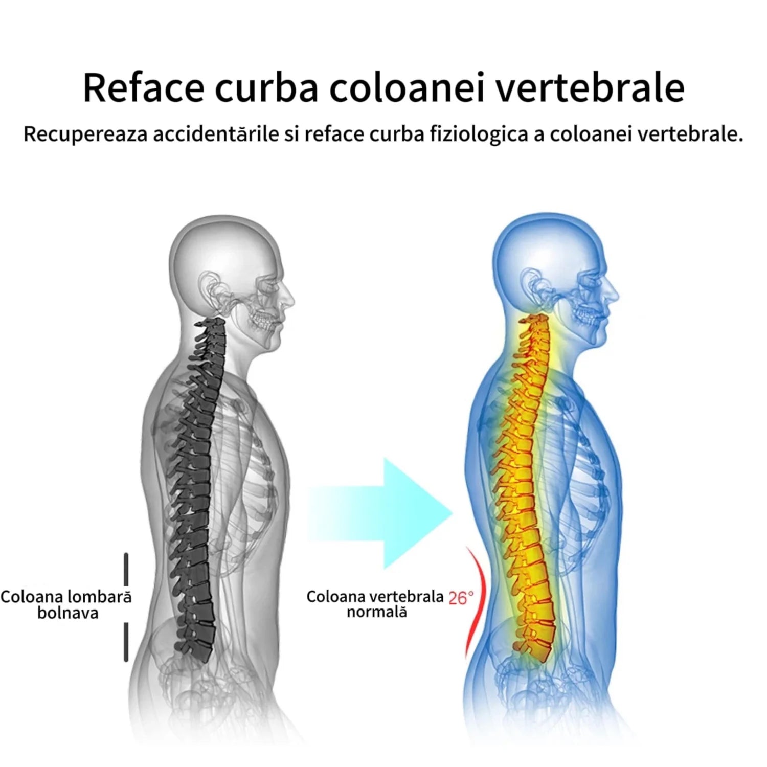 Centura lombara cu magneti si turmalina RelaxU © - RelaxU.ro