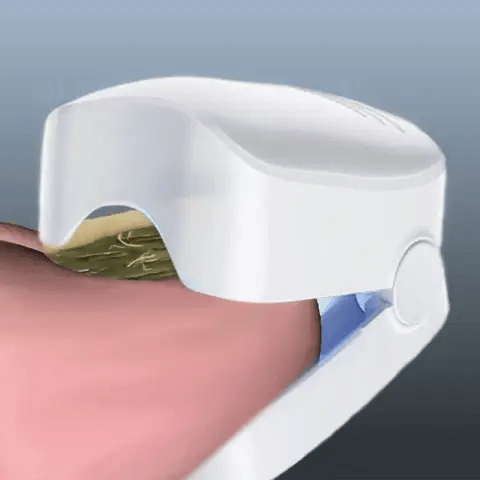 Dispozitiv Laser Pentru Îndepărtarea Ciupercii Unghiilor RelaxU © - RelaxU.ro