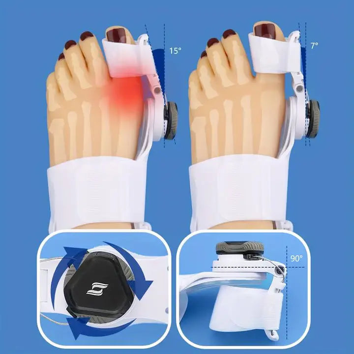 Corector pentru monturi, elimininarea inflamatiilor RelaxU © - RelaxU.ro